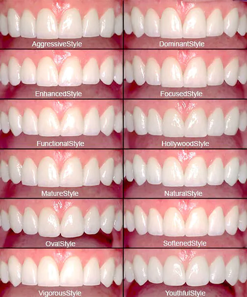 理想の歯並びを実現するための歯の透明感と色や形にこだわったデザイン