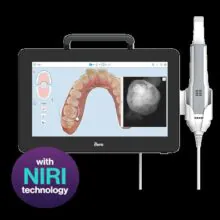 iTero element5D Plusでむし歯の早期発見・早期治療が可能です！