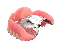 金属床義歯（保険適用外）